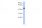CACNB4 antibody - middle region